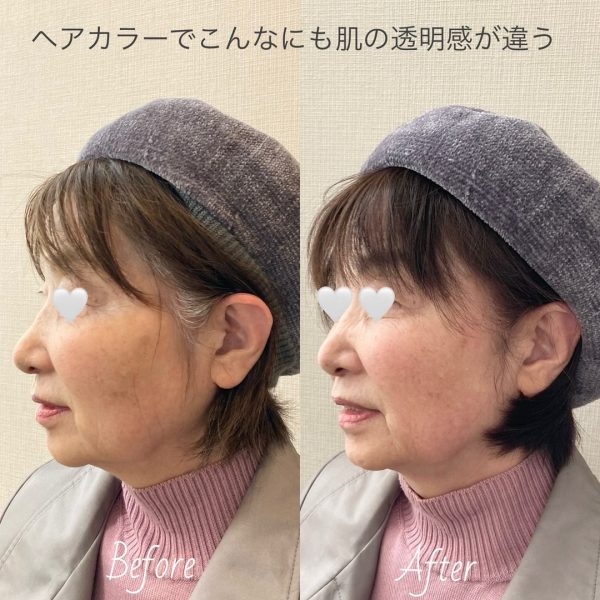 20250417